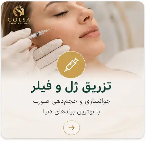 تزریق فیلر و ژل لب برای زاویه‌سازی صورت در نیشابور